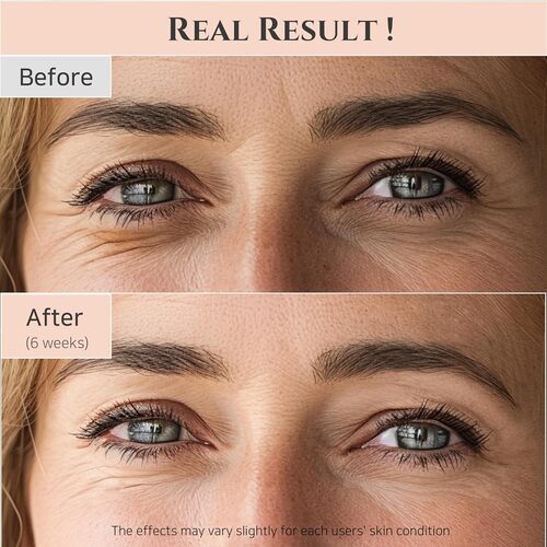 Sérum contorno de ojos Revive: Ginseng + Retinal 30 ml