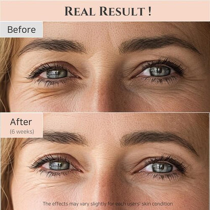 Sérum contorno de ojos Revive: Ginseng + Retinal 30 ml